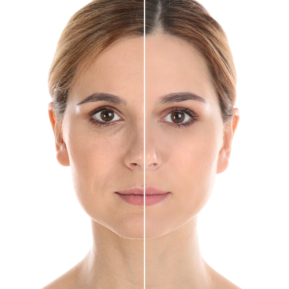 Cirugía Estética Facial Barcelona
