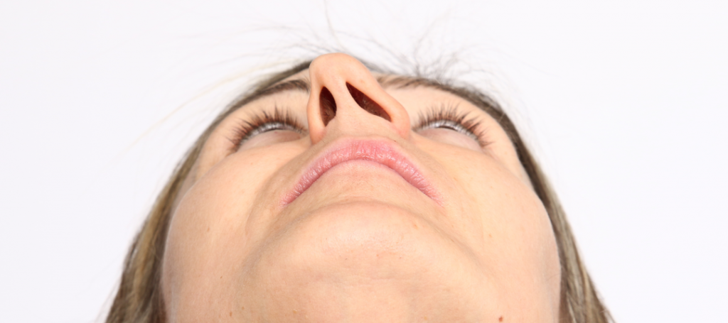 septoplastia