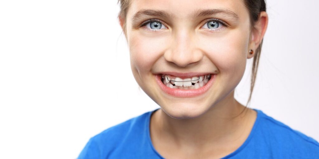 ortodoncia-en-nens