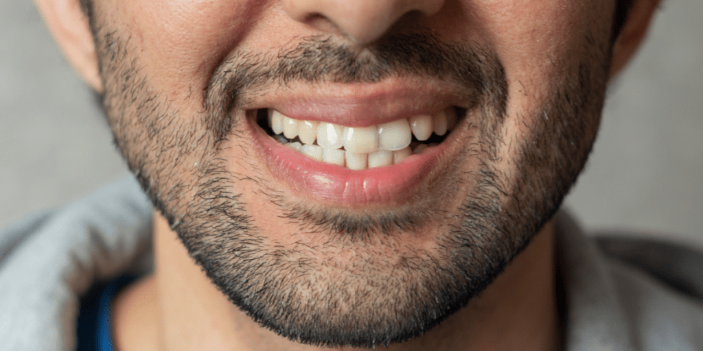 desplazamiento dental