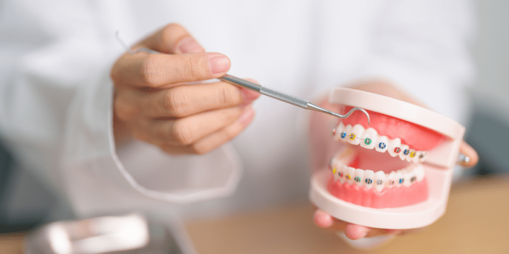 caries con ortodoncia