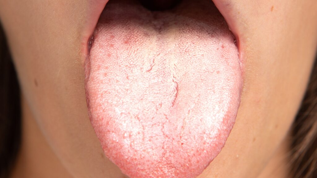 lengua saburral