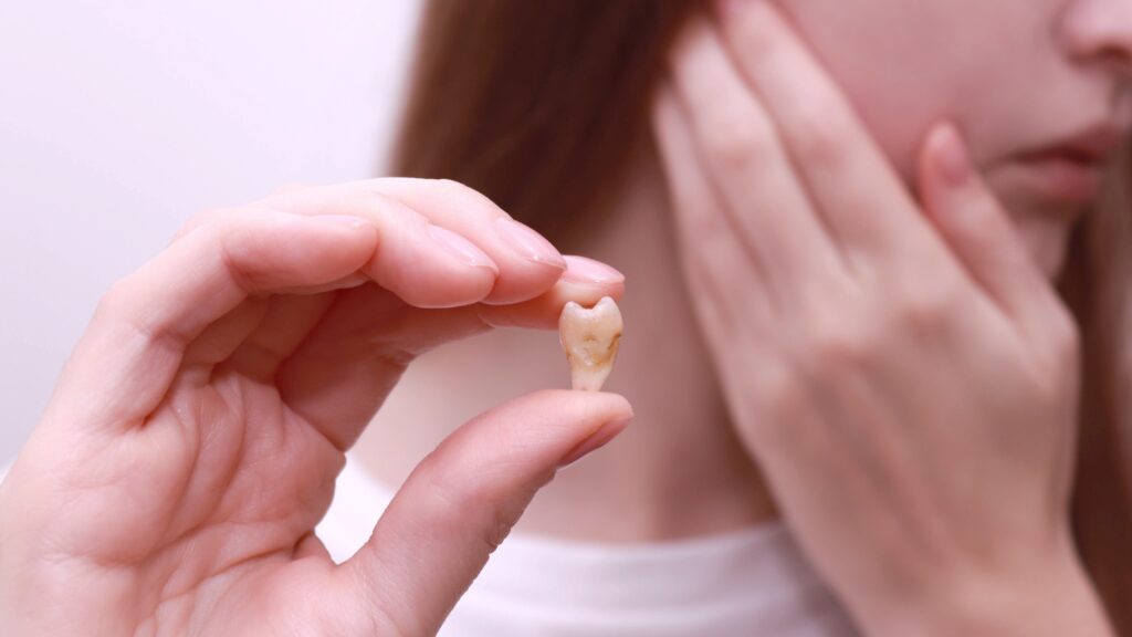 muelas de leche en adultos