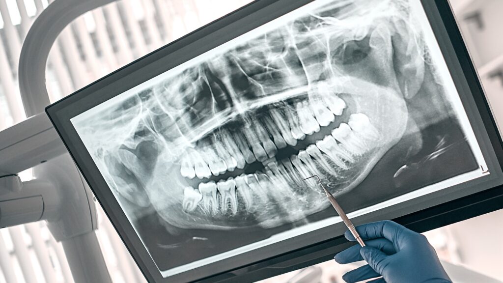 nombre de los dientes